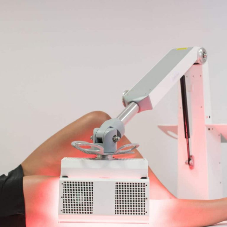 fotodinamine terapija